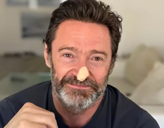 Hugh Jackman Is Seen With A Nose Bandage